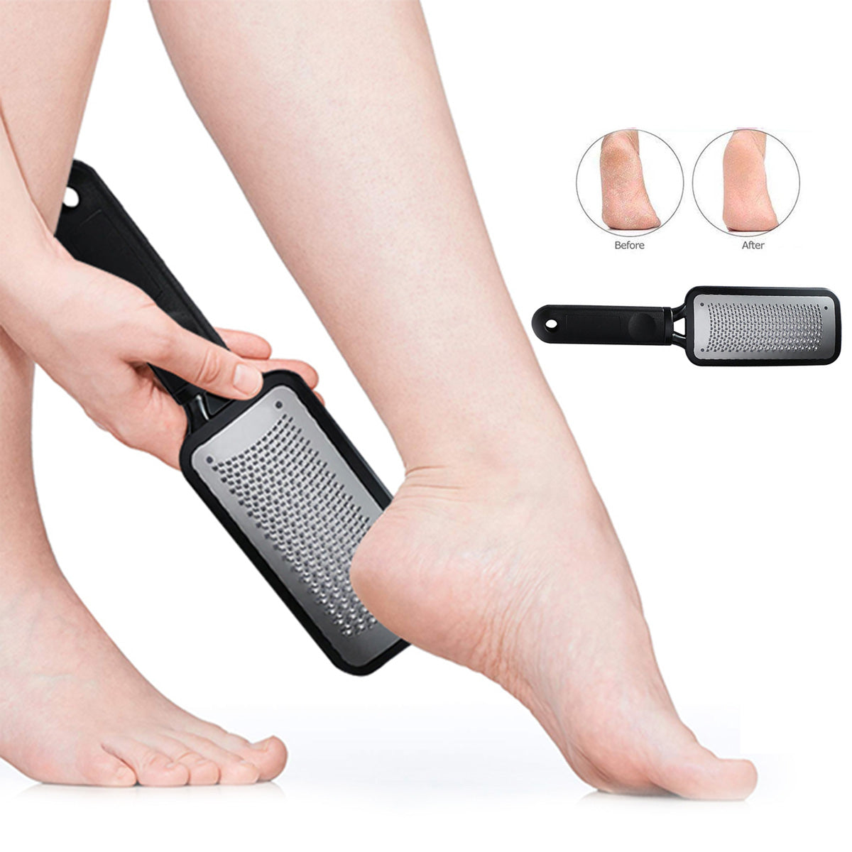 Foot Callus Remover for Feet - Professional Foot Scrubber Dead Skin Remover  with Medical Grade Steel - Ergonomic and Easy to Use Foot File Callus